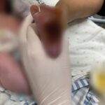 Point blur aug222025 074210