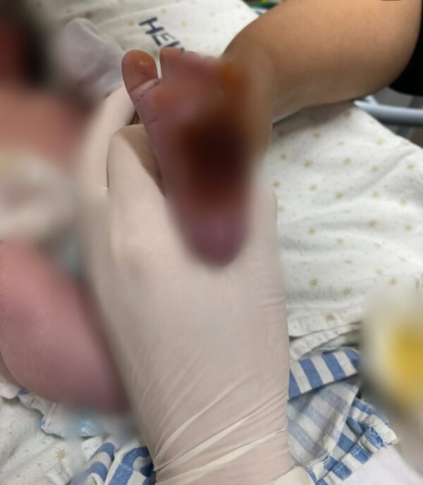 Point blur aug222025 074210