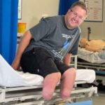 1719207084 cirurgiao congela proprias pernas indenizacao condenado